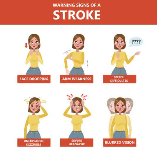 Stroke Info Graphic
